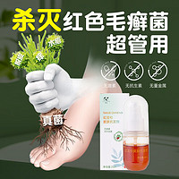 柠浩 脚气抗菌剂喷雾型25ml 止痒脱皮烂脚丫真菌感染