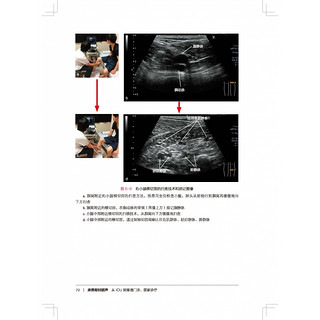 床旁即时超声 全书共10章 介绍了床旁超声在气道管理 呼吸 循环 中枢神经 下肢静脉血栓