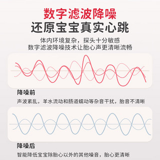 AUX 奥克斯 M521 胎心监测仪 蓝牙款