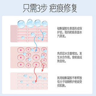 李护士祛疤痕膏儿童 巴克成人医用硅酮疤痕凝胶去剖腹产疤烫伤烧伤外伤 20g/支