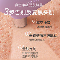 88VIP：FOREO KIWI derma黑頭吸塵器 院線級無痛去黑頭