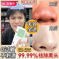 海洋主义（Socus） 去黑头收缩毛孔鼻贴清洁男女士T区护理黑头导出液 40片