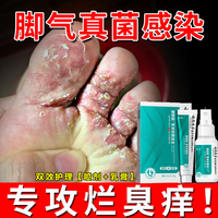  鑫博士 草本抑菌 脚气喷剂套装  35ml+20g