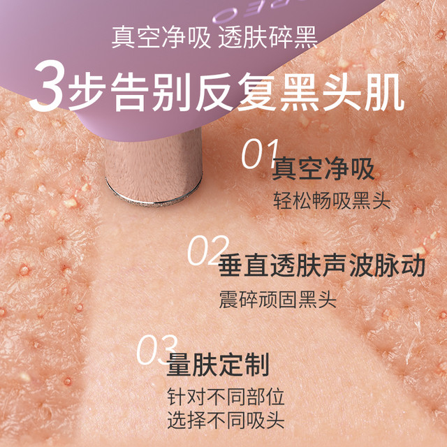 88VIP：FOREO 斐珞尔 KIWI derma黑头吸尘器 院线级无痛去黑头