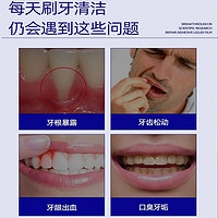 医用漱口水杀菌消炎牙周炎牙龈萎缩除口臭持久留香牙结石簌遬口水