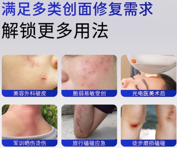 补贴购:可复佳 kefujia 医用多聚糖生物敷料凝胶型 15g 激光术后烧烫光子微整愈合