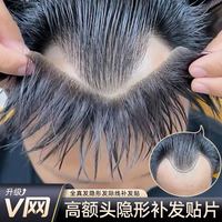 贝尔秀 深v形发际线假发贴假刘海假发片m形发际线贴男一片式前额补发真发