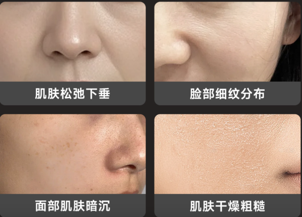 小米众筹,光电复合胶原炮,情人节送礼首选