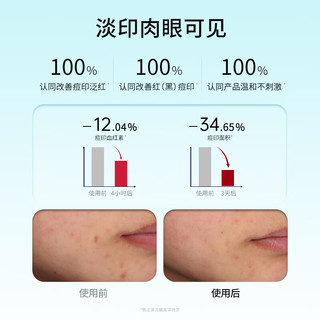 JOVS骄予时家用美容仪器紧急祛痘熬夜姨妈痘青春痘淡印水杨酸送男女友光疗祛痘贴