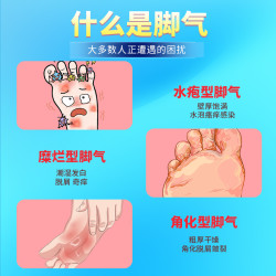 立可邦 盐酸特比萘芬乳膏1%*10g手足癣体癣花斑癣皮肤念珠菌病