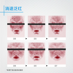 芙清 壬二酸祛痘精华乳膏控油淡化痘印清洁去黑头闭口粉刺乳液 祛痘精华乳15g