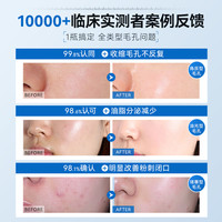 B5毛孔精华液修复收缩毛孔粗大男士湿敷水水杨酸控油祛痘去黄提亮