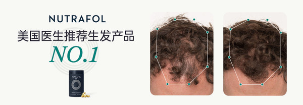评论有奖：评论&浏览有奖！可复佳+联合利华 限时福利ing，评论互动赢碎银、黄金胶囊、医用级敷料～