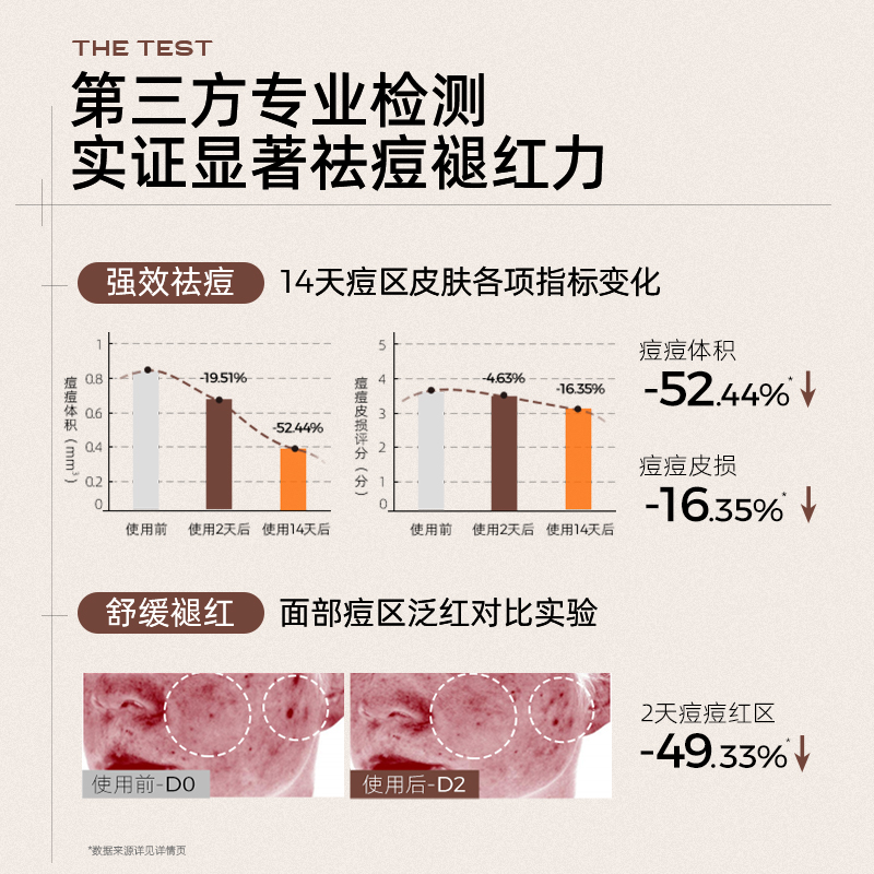 C咖祛痘膏胶态硫点涂褪红闭口粉刺舒缓控油改善油痘肌淡化痘印