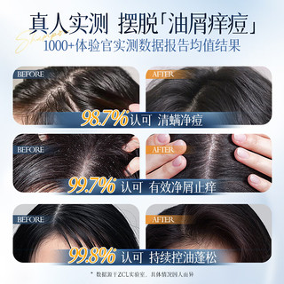  ZCL 去屑止痒控油蓬松留香 洗发水  500ml