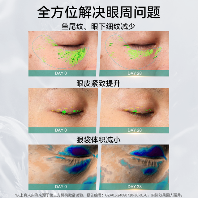 纪芝 美眼仪淡化眼袋眼纹提亮眼周冷热敷紧致眼部按摩美容仪微电流