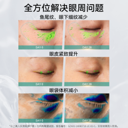 纪芝 美眼仪淡化眼袋眼纹提亮眼周冷热敷紧致眼部按摩美容仪微电流