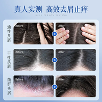 Vetes/维特丝 去屑止痒控油 二硫化硒洗发水