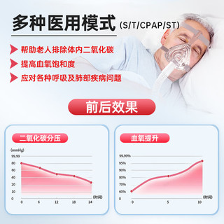 比扬 P1双水平ST无创呼吸机 25cmH2O压力 医用级