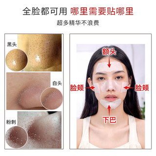 如薇（RNW）双重净润去黑头鼻贴膜1组2片免撕拉面膜精华液粉刺收缩毛孔送女士 去黑头鼻贴1组