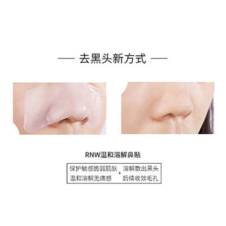 如薇（RNW）双重净润去黑头鼻贴膜1组2片免撕拉面膜精华液粉刺收缩毛孔送女士 去黑头鼻贴1组