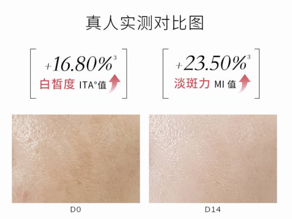 敷尔佳 臻白面膜1盒（5片）