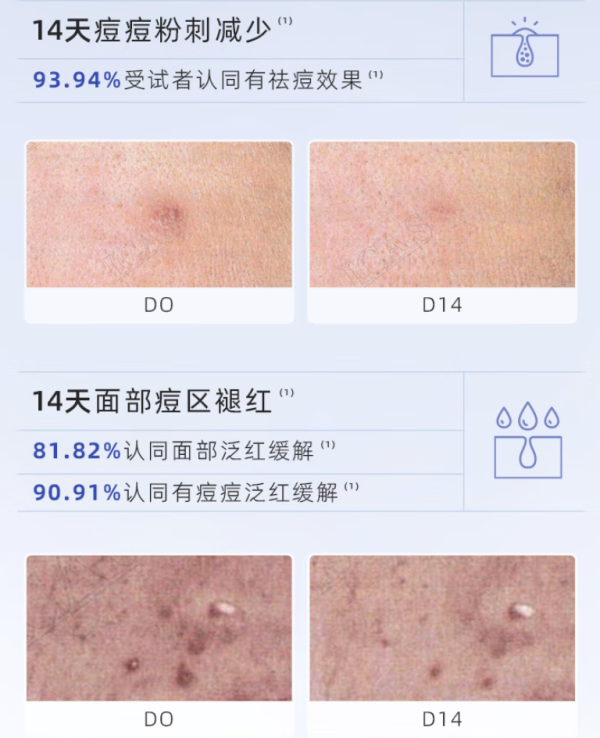 敷尔佳 清痘净肤修护贴祛痘面膜水杨酸痘肌油痘肌补水保湿 单盒装