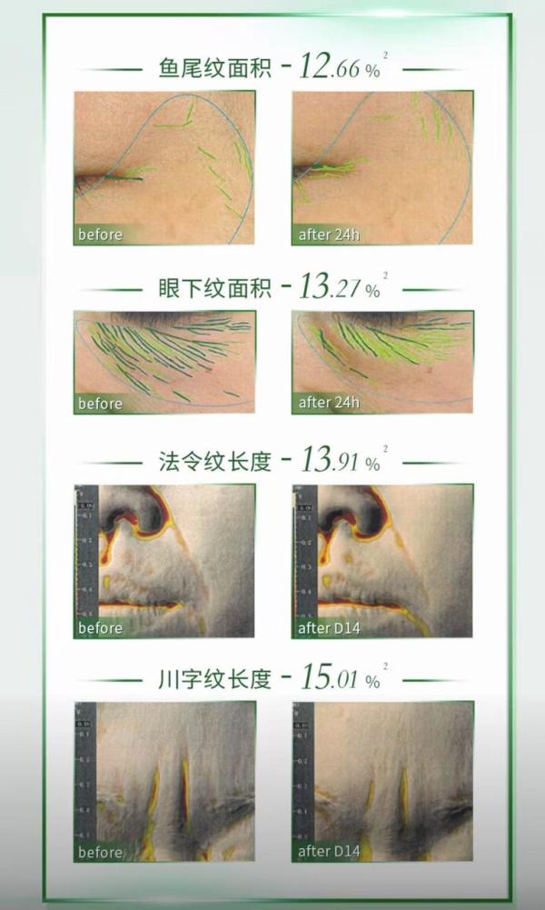 新品发售:敷尔佳「胶原舱」重磅上市,一支搞定胶原外增内补!