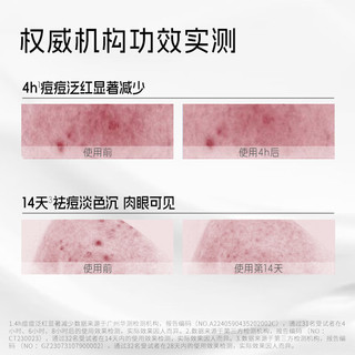 喜辽妥 祛痘精华霜 20%浓度 水杨酸 凝血酸 皮肤用药