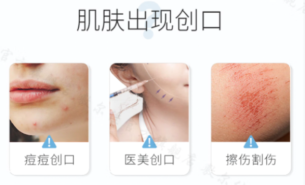 敷尔佳这几款宝藏单品一定要拥有,换季敏感、术后修复、痤疮缓解全搞定!