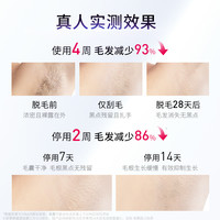 限地区：Ulike 蓝宝石冰点脱毛仪器女士家用女生专用非激光全身腋下毛air3