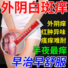  dkn/达克宁 止痒杀菌 妇科外阴瘙痒软膏