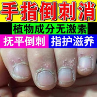 久木堂 手指倒刺起皮修护营养液儿童防倒刺指缘油小孩手指倒刺 10ml1盒