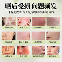 焦博士日本晒后修复面膜修复敏感泛红晒伤医美护补水复活草防白用 1盒晒后修复面膜【优惠装】