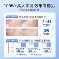  BEAI 补水控油 祛痘面膜  20片