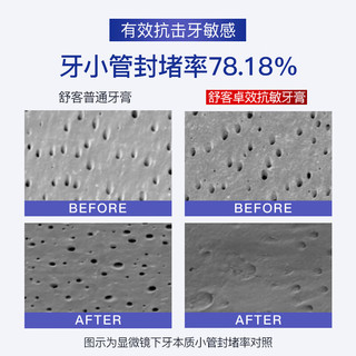  Saky/舒客 抗敏美白 牙膏  茉莉+薄荷 240g