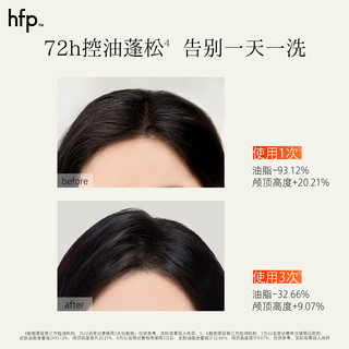  HomeFacialPro 控油蓬松 果酸洗发水