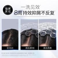 净屑调理洗发露460ml去屑舒缓调理洗发水