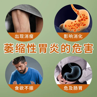 三九 999保障国药准字养胃舒胶囊OTC胃病药治糜烂性胃炎慢性胃炎萎缩性胃炎药可选养胃舒胶囊 3盒装【疗程装】快速改善胃病症状