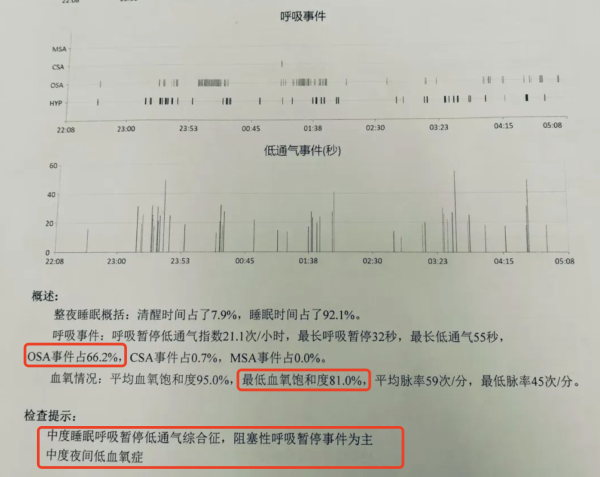 中年男人靠瑞迈特家用呼吸机自救,打鼾族终于知道‘一觉到天亮’是什么滋味了!