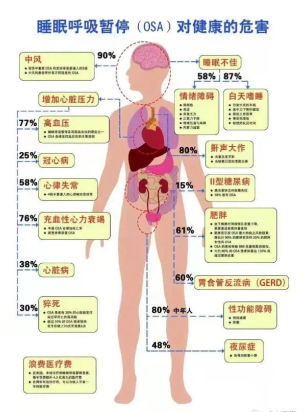 中年男人靠瑞迈特家用呼吸机自救,打鼾族终于知道‘一觉到天亮’是什么滋味了!