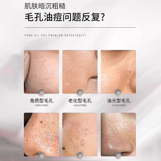 甘醇酸果酸精华水美身体白喷雾医补水保湿收缩毛孔精华液用爽肤水
