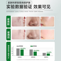 HUNMUI 水杨酸净颜清肌棉片收缩毛孔水油平衡湿敷面膜 温和型修护棉片2ml 55片 1罐(绿瓶)