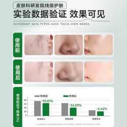 HUNMUI 水杨酸净颜清肌棉片收缩毛孔水油平衡湿敷面膜 温和型修护棉片2ml 55片 1罐绿瓶
