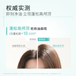 Clinitech 控油头皮素30ml去头屑修护保湿舒缓清洁头皮洗发水