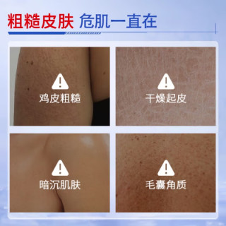  BAILUHUI 减轻鸡皮肤干燥脱皮 维A酸乳膏+维E尿素霜软膏  2盒装