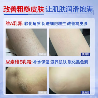  BAILUHUI 减轻鸡皮肤干燥脱皮 维A酸乳膏+维E尿素霜软膏  2盒装