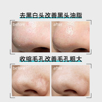 ilso一苏黑头导出液韩国黑头水套装控油去黑头粉刺深度清洁