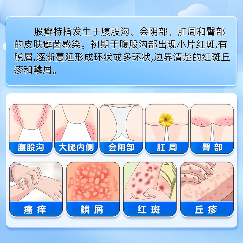  仁和堂 抗真菌感染 盐酸特比萘芬乳膏