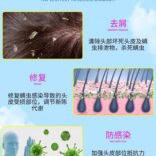  KANGWANG/康王 去头皮屑 去屑止痒洗发水